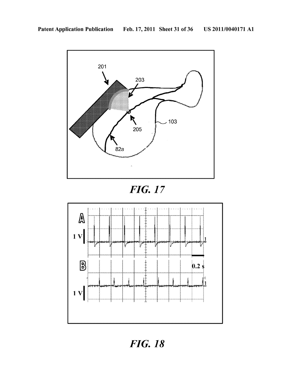 IMAGE GUIDED HIGH INTENSITY FOCUSED ULTRASOUND TREATMENT OF NERVES - diagram, schematic, and image 32