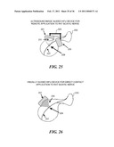 IMAGE GUIDED HIGH INTENSITY FOCUSED ULTRASOUND TREATMENT OF NERVES diagram and image