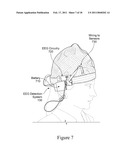 SENSORY-EVOKED POTENTIAL (SEP) CLASSIFICATION/DETECTION IN THE TIME DOMAIN diagram and image