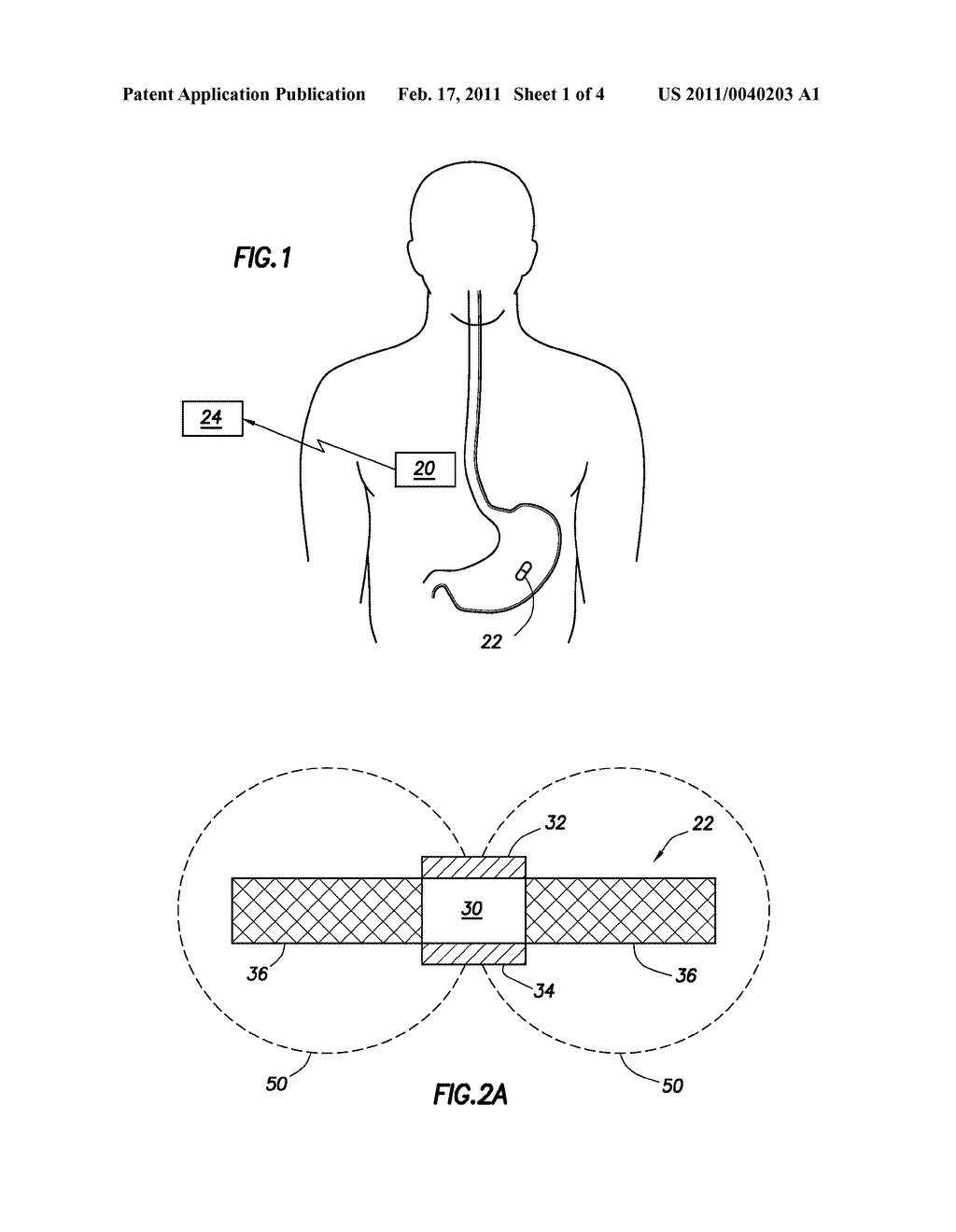 EVALUATION OF GASTROINTESTINAL FUNCTION USING PORTABLE ELECTROVISCEROGRAPHY SYSTEMS AND METHODS OF USING THE SAME - diagram, schematic, and image 02