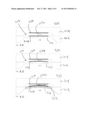 IN SITU OFFSET COMPENSATION FOR PRESSURE SENSORS diagram and image