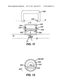 Ultrasonic Surgical Apparatus with Silicon Waveguide diagram and image