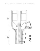 Ultrasonic Surgical Apparatus with Silicon Waveguide diagram and image