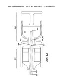 Ultrasonic Surgical Apparatus with Silicon Waveguide diagram and image