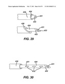 Ultrasonic Surgical Apparatus with Silicon Waveguide diagram and image