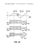 Ultrasonic Surgical Apparatus with Silicon Waveguide diagram and image