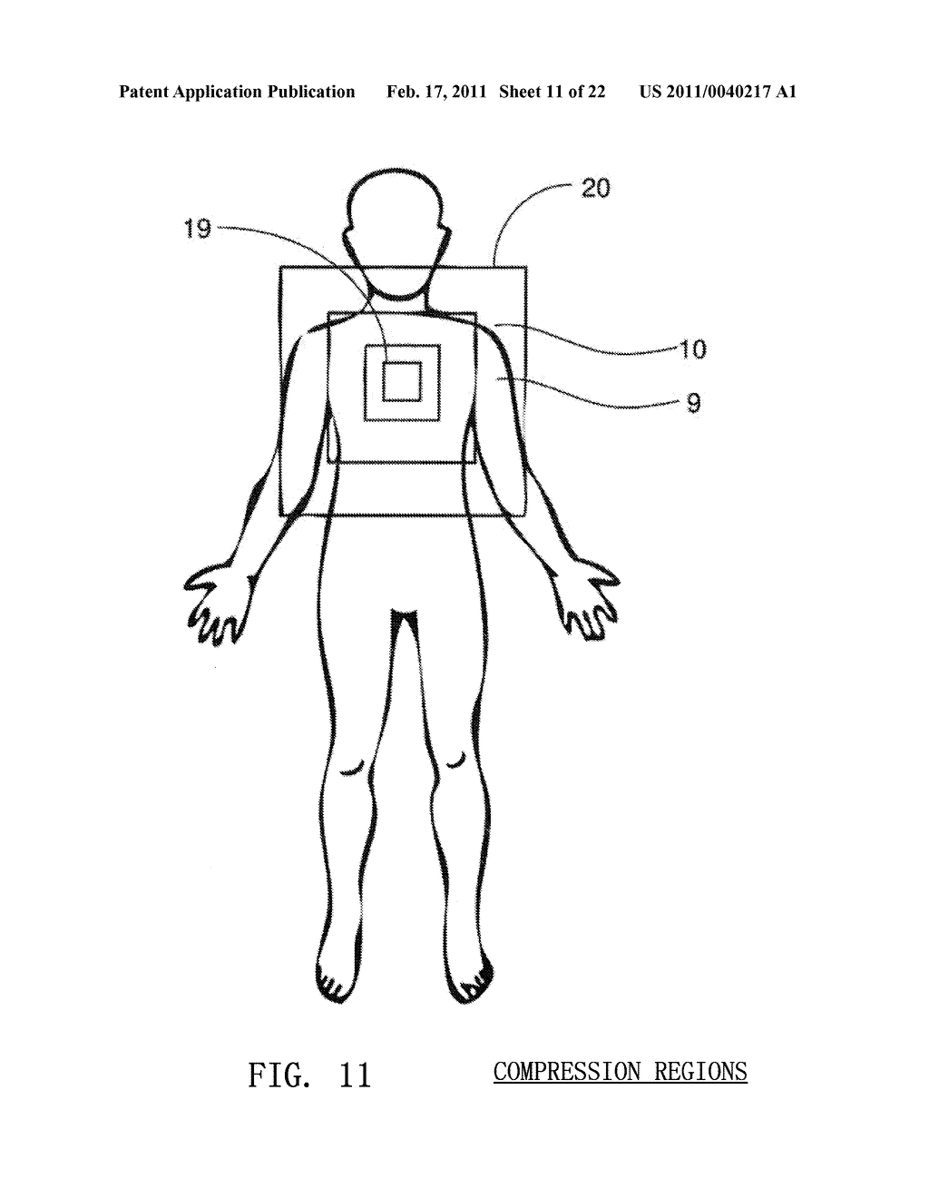 OPTICAL TECHNIQUES FOR THE MEASUREMENT OF CHEST COMPRESSION DEPTH AND OTHER PARAMETERS DURING CPR - diagram, schematic, and image 12