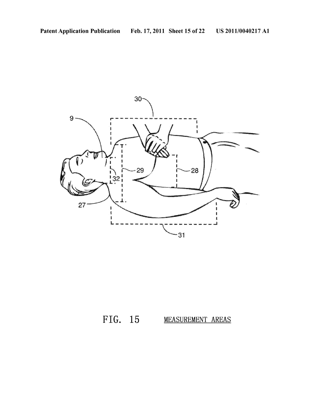 OPTICAL TECHNIQUES FOR THE MEASUREMENT OF CHEST COMPRESSION DEPTH AND OTHER PARAMETERS DURING CPR - diagram, schematic, and image 16