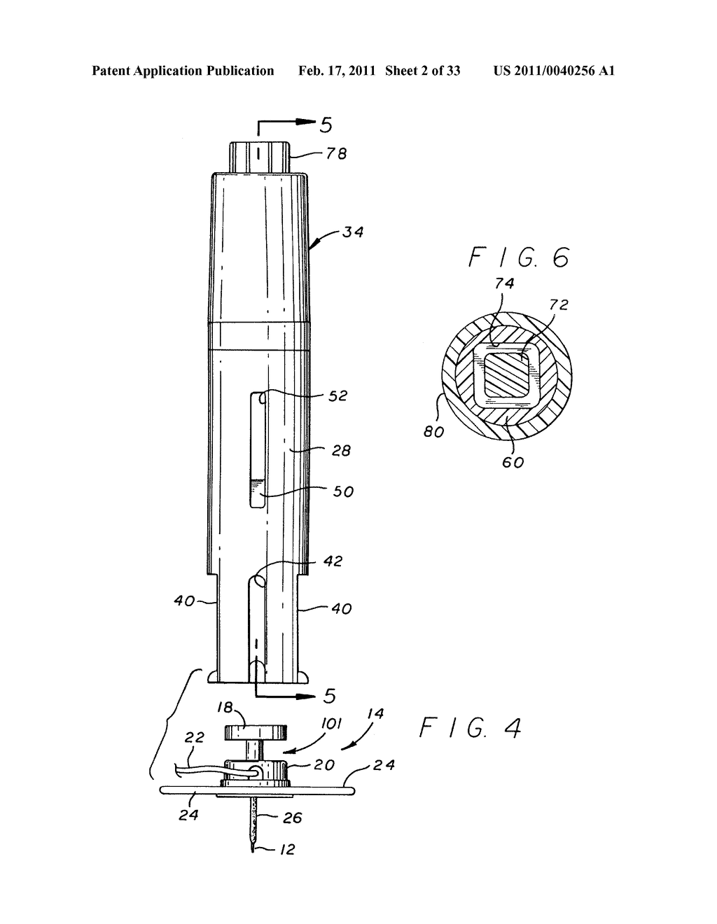 Insertion Device for an Insertion Set and Method of Using the Same - diagram, schematic, and image 03