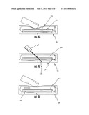 DEVICE AND METHODS TO FACILITATE CANNULATION AND PREVENT NEEDLE PUNCTURE BLEEDING OF AN ARTERIOVENOUS FISTULA diagram and image