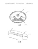 DEVICE AND METHODS TO FACILITATE CANNULATION AND PREVENT NEEDLE PUNCTURE BLEEDING OF AN ARTERIOVENOUS FISTULA diagram and image