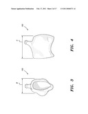 Urine Catchment Device diagram and image