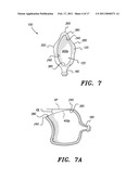 Urine Catchment Device diagram and image