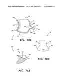 Urine Catchment Device diagram and image