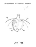 Urine Catchment Device diagram and image