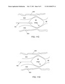 Particle Delivery diagram and image