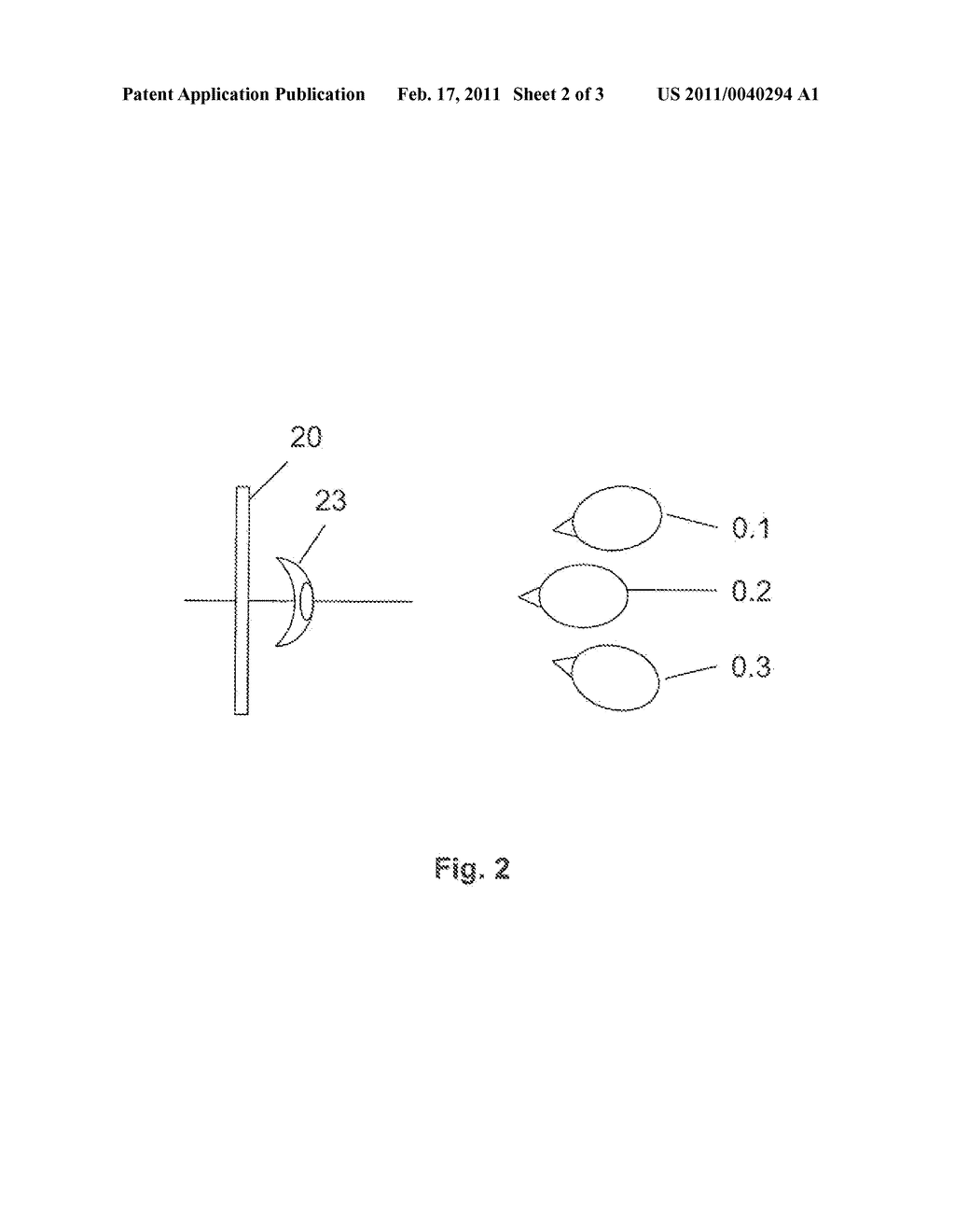 Method and device for the representation of an operation area during laser operations - diagram, schematic, and image 03