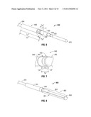 Surface Ablation Antenna with Dielectric Loading diagram and image