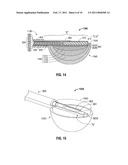 Surface Ablation Antenna with Dielectric Loading diagram and image