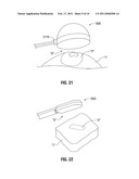 Surface Ablation Antenna with Dielectric Loading diagram and image