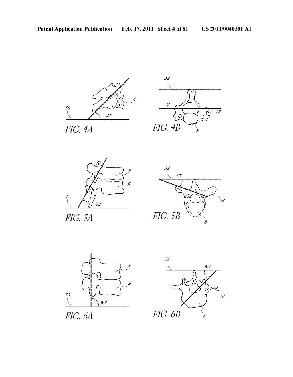 VERTEBRAL FACET JOINT DRILL AND METHOD OF USE - diagram, schematic, and image 05