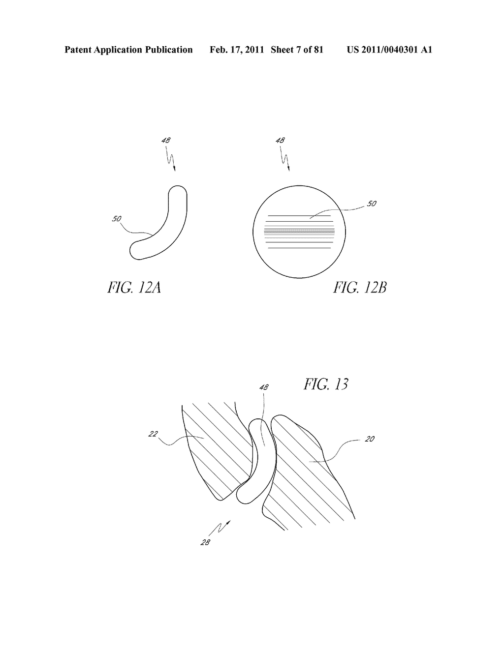 VERTEBRAL FACET JOINT DRILL AND METHOD OF USE - diagram, schematic, and image 08