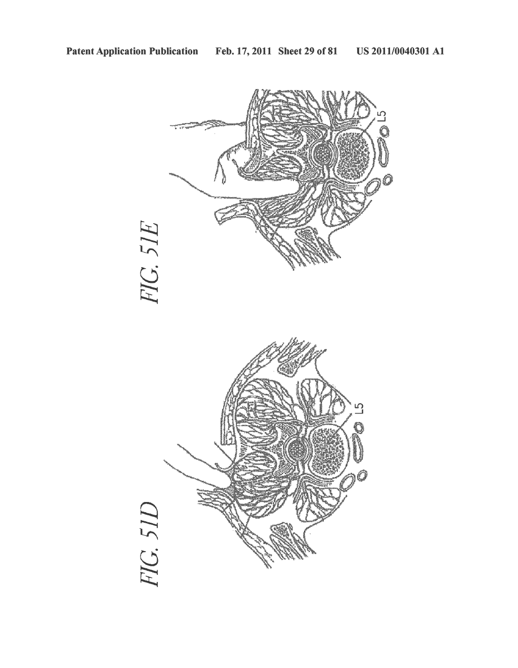 VERTEBRAL FACET JOINT DRILL AND METHOD OF USE - diagram, schematic, and image 30