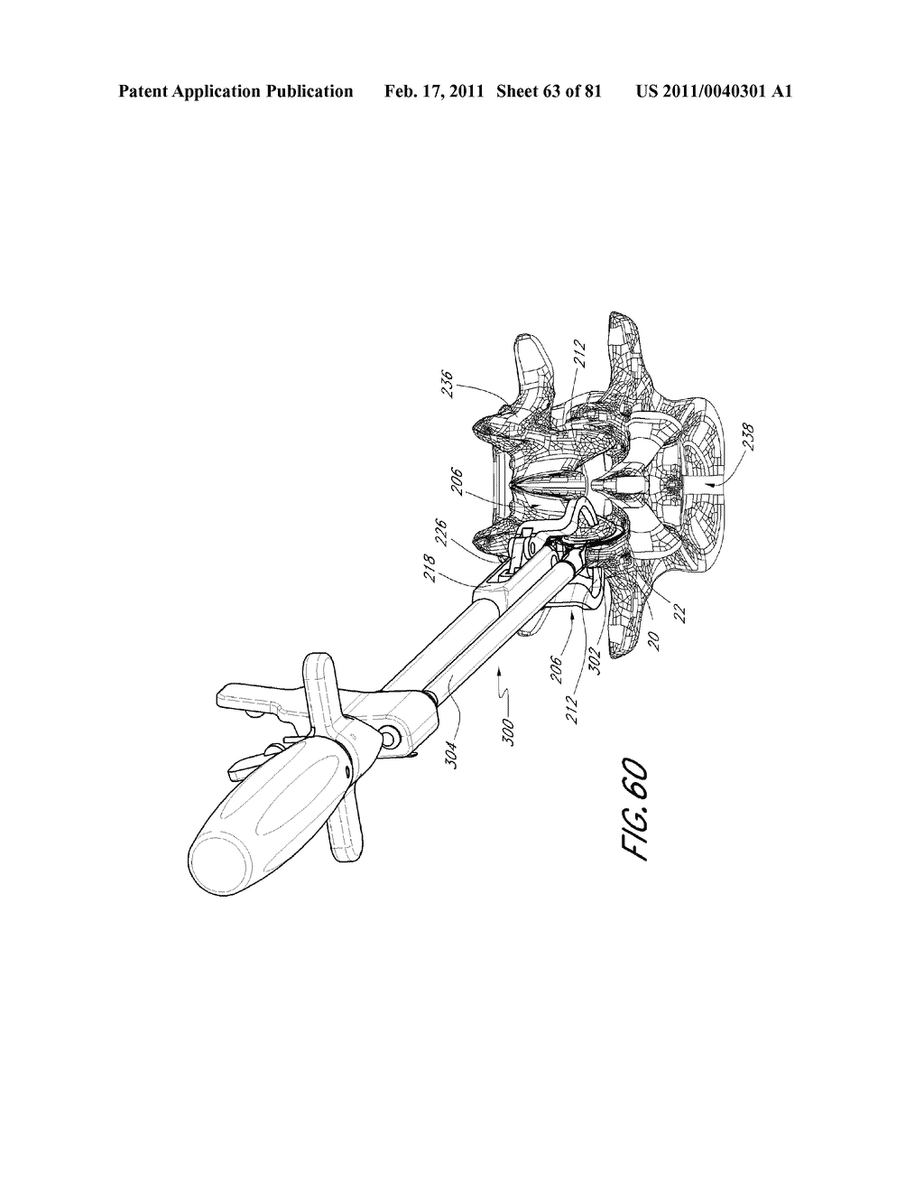 VERTEBRAL FACET JOINT DRILL AND METHOD OF USE - diagram, schematic, and image 64