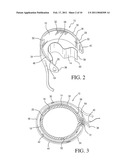 IMPLANTABLE RESTRICTION DEVICE WITH SPACER diagram and image