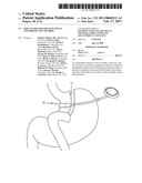 IMPLANTABLE RESTRICTION DEVICE WITH PROTECTIVE MEMBER diagram and image