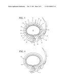 IMPLANTABLE RESTRICTION DEVICE WITH PROTECTIVE MEMBER diagram and image