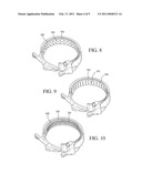 IMPLANTABLE RESTRICTION DEVICE WITH PROTECTIVE MEMBER diagram and image