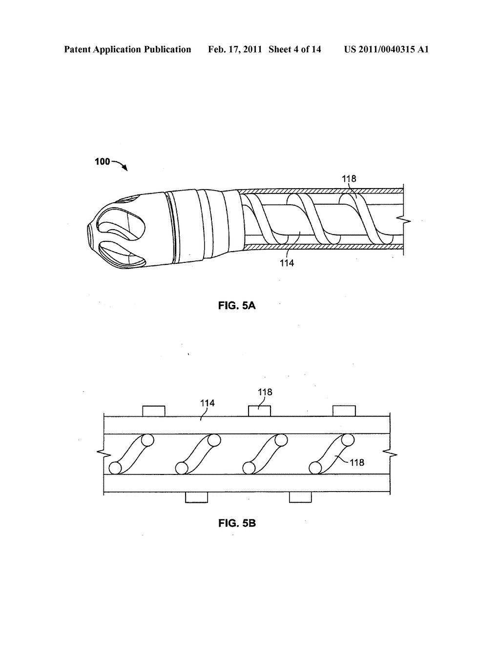 Devices, systems, and methods for cutting and removing occlusive material from a body lumen - diagram, schematic, and image 05