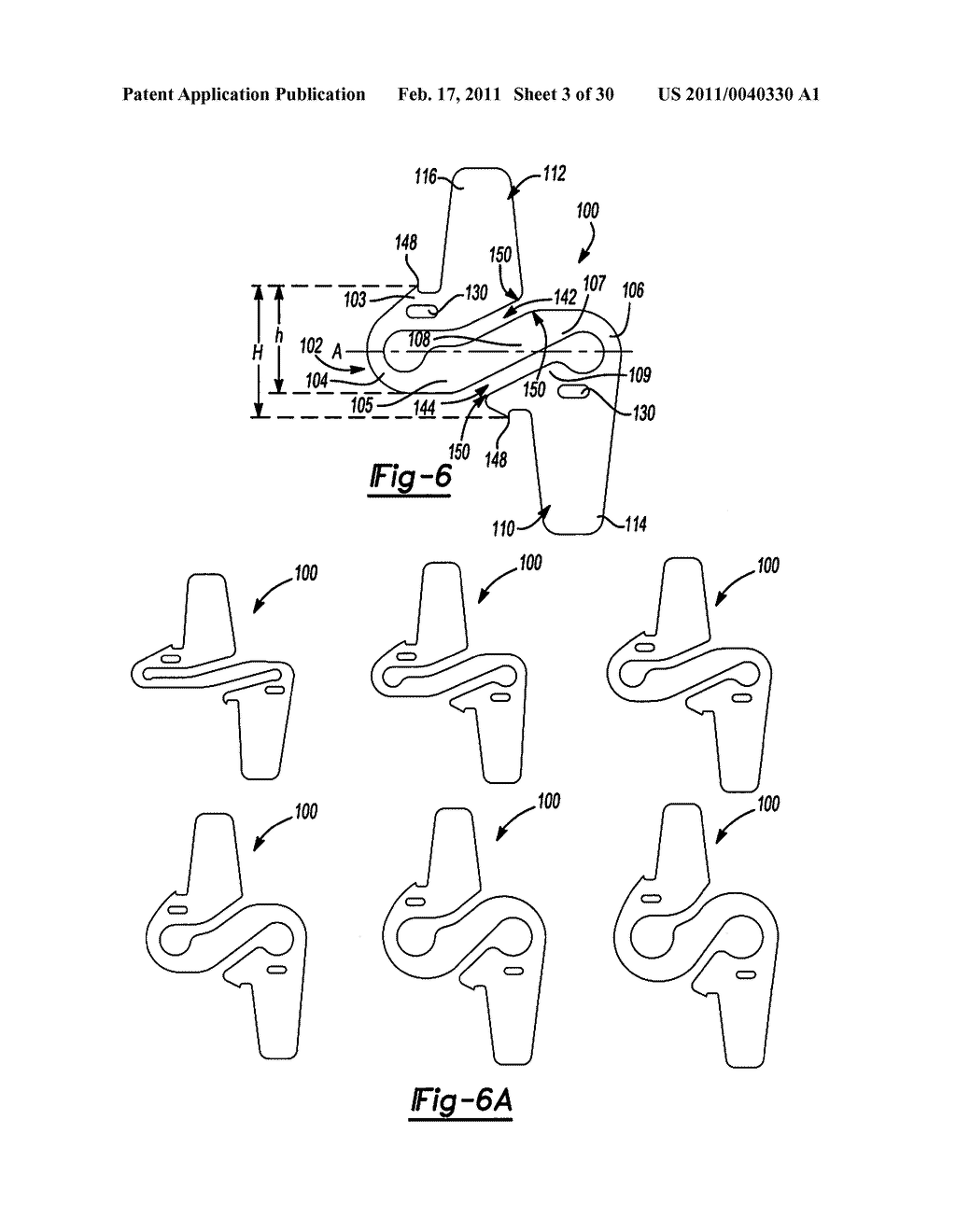 INTERSPINOUS IMPLANT - diagram, schematic, and image 04