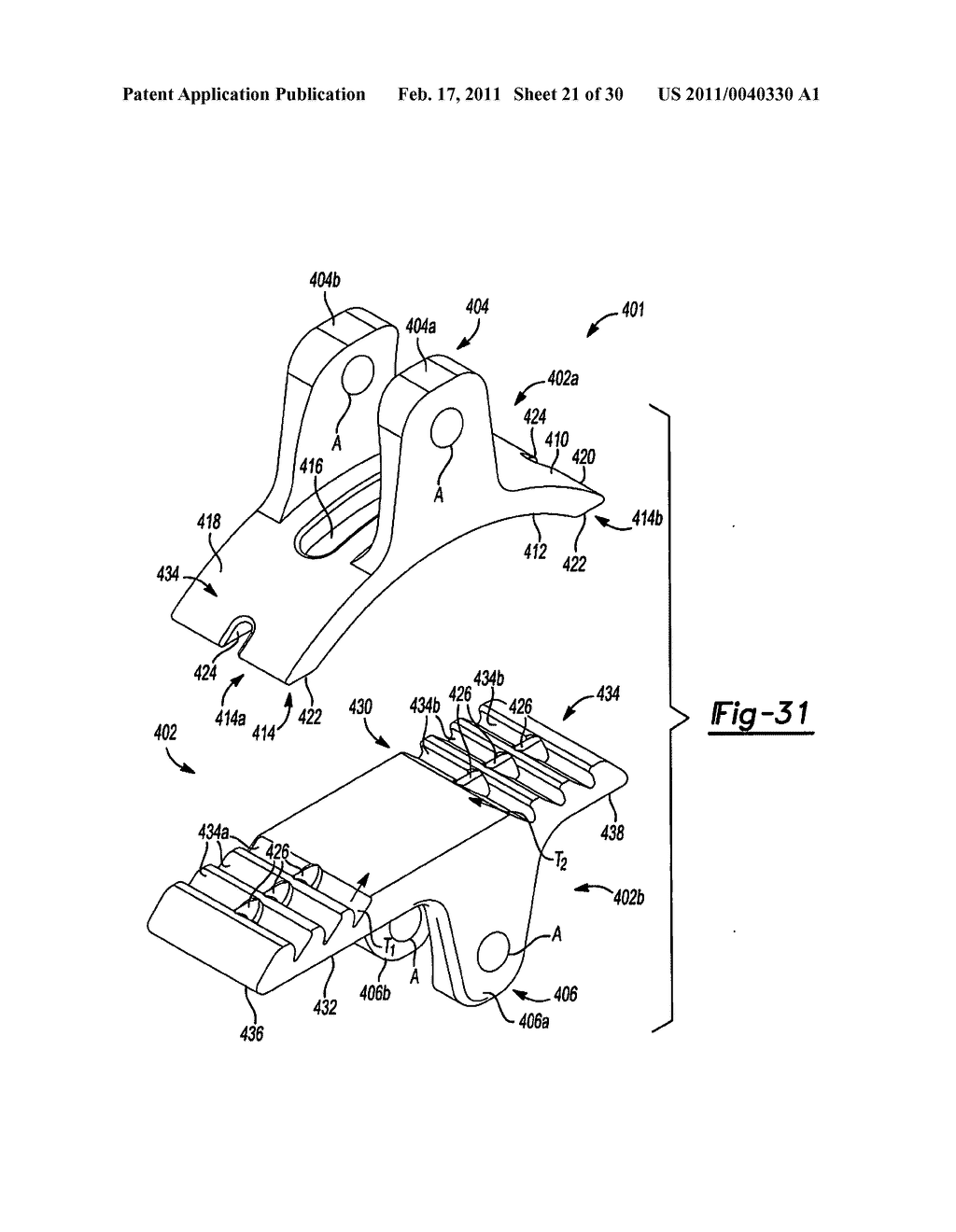 INTERSPINOUS IMPLANT - diagram, schematic, and image 22