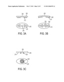 SURGICAL SCREW AND METHOD OF PERFORMING LIGAMENT RECONSTRUCTION USING SAID SCREW diagram and image