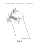 SURGICAL SCREW AND METHOD OF PERFORMING LIGAMENT RECONSTRUCTION USING SAID SCREW diagram and image