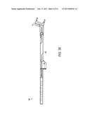 ARTHROPLASTY REVISION DEVICE AND METHOD diagram and image