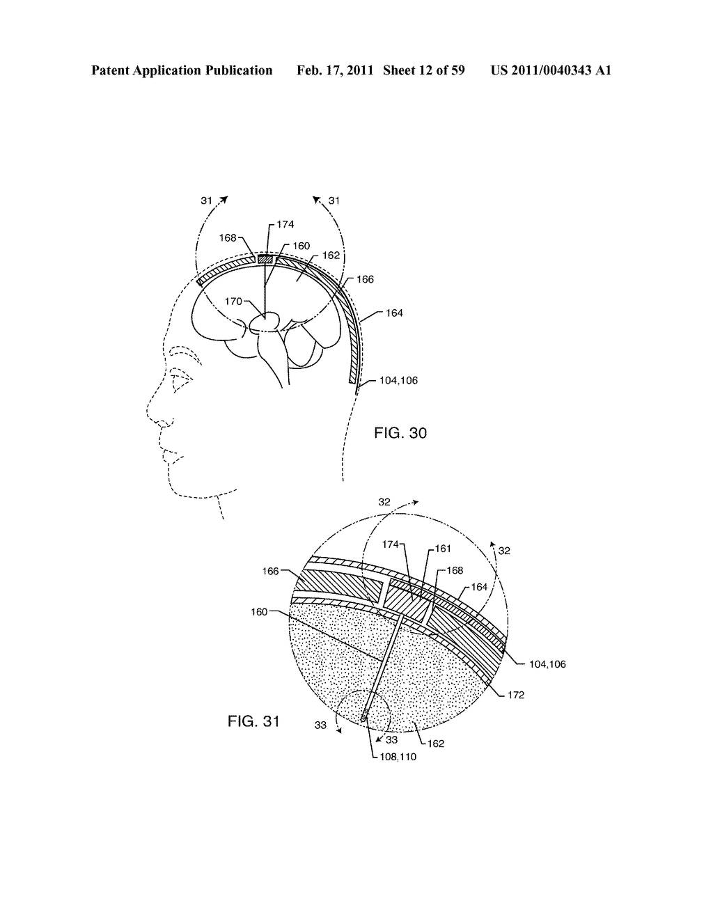 SWITCHED DIVERTER CIRCUITS FOR MINIMIZING HEATING OF AN IMPLANTED LEAD IN A HIGH POWER ELECTROMAGNETIC FIELD ENVIRONMENT - diagram, schematic, and image 13