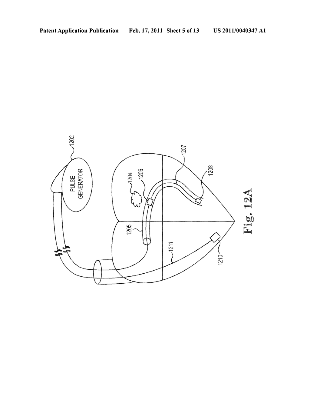 INTEGRATED LEAD FOR APPLYING CARDIAC RESYNCHRONIZATION THERAPY AND NEURAL STIMULATION THERAPY - diagram, schematic, and image 06