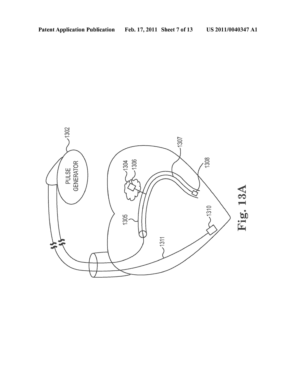 INTEGRATED LEAD FOR APPLYING CARDIAC RESYNCHRONIZATION THERAPY AND NEURAL STIMULATION THERAPY - diagram, schematic, and image 08