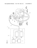 ELECTRODE LAYOUT METHOD OF HEART TREATMENT APPARATUS diagram and image