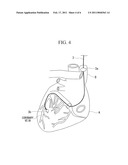 ELECTRODE LAYOUT METHOD OF HEART TREATMENT APPARATUS diagram and image