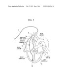 ELECTRODE LAYOUT METHOD OF HEART TREATMENT APPARATUS diagram and image