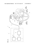 ELECTRODE LAYOUT METHOD OF HEART TREATMENT APPARATUS diagram and image