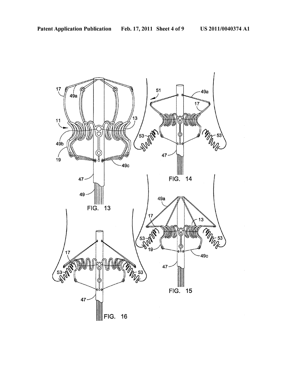 MINIMALLY INVASIVE HEART VALVE REPLACEMENT - diagram, schematic, and image 05