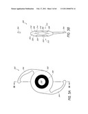 MASKED INTRAOCULAR IMPLANTS AND LENSES diagram and image