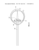 MASKED INTRAOCULAR IMPLANTS AND LENSES diagram and image