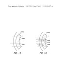 MASKED INTRAOCULAR IMPLANTS AND LENSES diagram and image