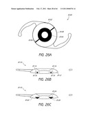 MASKED INTRAOCULAR IMPLANTS AND LENSES diagram and image